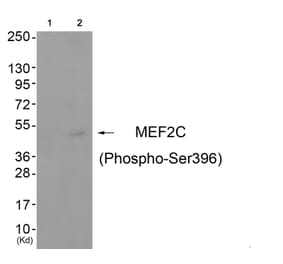 Western blot - MEF2C (Phospho-Ser396) Antibody from Signalway Antibody (11808) - Antibodies.com