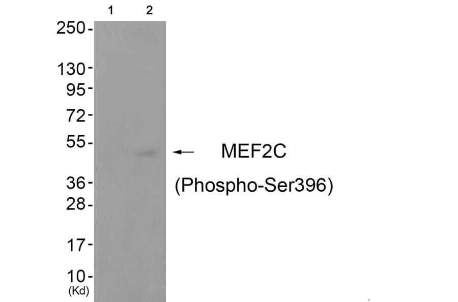 Western blot - MEF2C (Phospho-Ser396) Antibody from Signalway Antibody (11808) - Antibodies.com