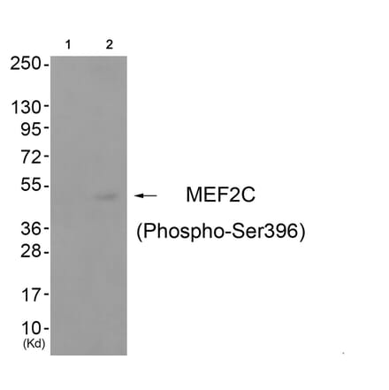 Western blot - MEF2C (Phospho-Ser396) Antibody from Signalway Antibody (11808) - Antibodies.com