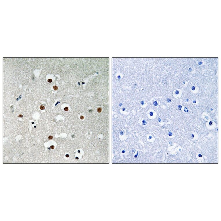 Immunohistochemistry - MEF2C (Phospho-Ser396) Antibody from Signalway Antibody (11808) - Antibodies.com