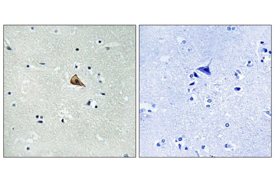 Immunohistochemistry - Trk A (Phospho-Tyr701) Antibody from Signalway Antibody (12115) - Antibodies.com