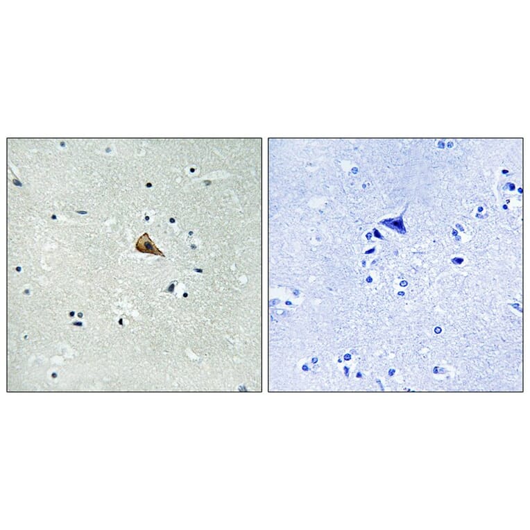 Immunohistochemistry - Trk A (Phospho-Tyr701) Antibody from Signalway Antibody (12115) - Antibodies.com