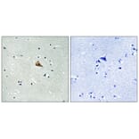 Immunohistochemistry - Trk A (Phospho-Tyr701) Antibody from Signalway Antibody (12115) - Antibodies.com