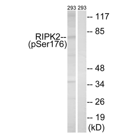 Western blot - RIPK2 (Phospho-Ser176) Antibody from Signalway Antibody (12120) - Antibodies.com