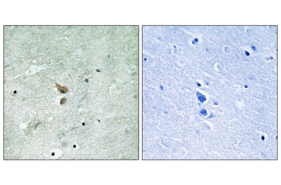 Immunohistochemistry - RIPK2 (Phospho-Ser176) Antibody from Signalway Antibody (12120) - Antibodies.com