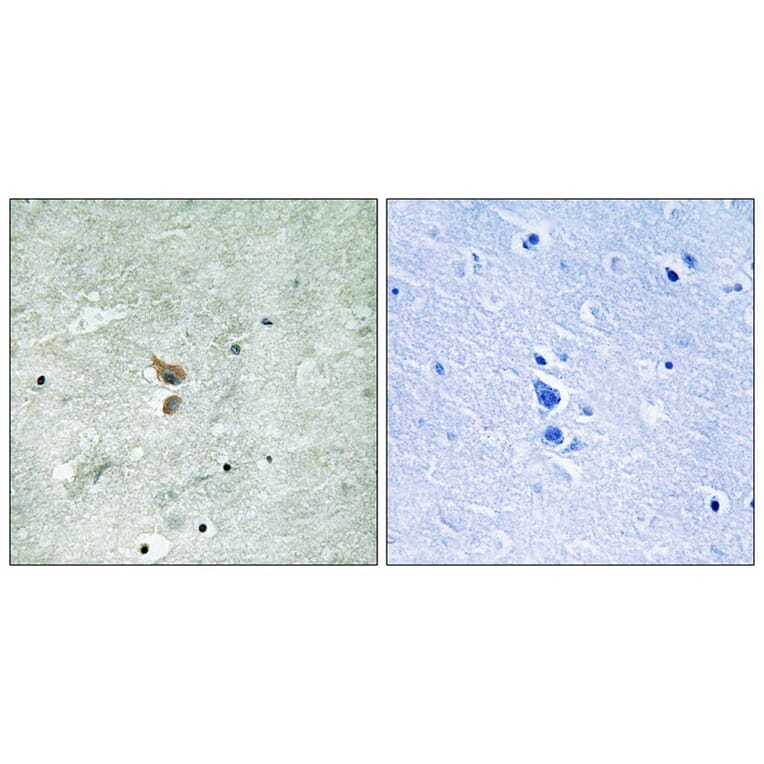 Immunohistochemistry - RIPK2 (Phospho-Ser176) Antibody from Signalway Antibody (12120) - Antibodies.com