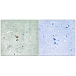 Immunohistochemistry - RIPK2 (Phospho-Ser176) Antibody from Signalway Antibody (12120) - Antibodies.com