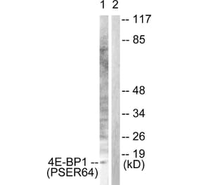 Western blot - 4E-BP1 (Phospho-Ser64) Antibody from Signalway Antibody (12124) - Antibodies.com