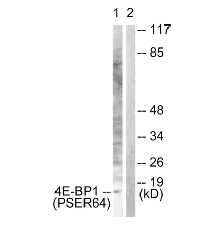 Western blot - 4E-BP1 (Phospho-Ser64) Antibody from Signalway Antibody (12124) - Antibodies.com