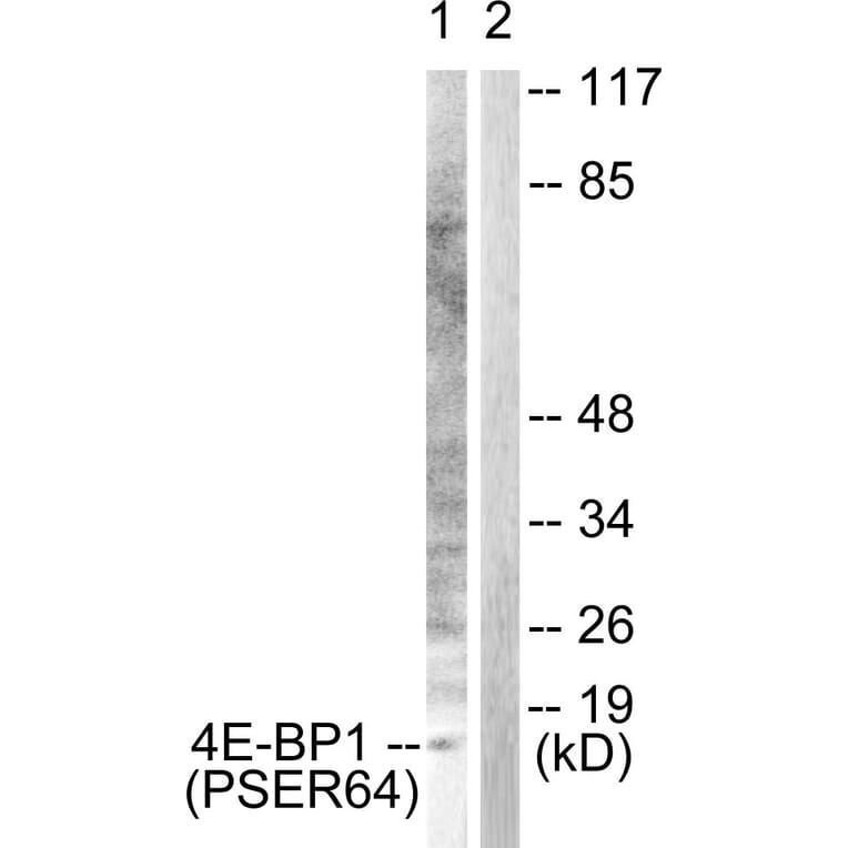 Western blot - 4E-BP1 (Phospho-Ser64) Antibody from Signalway Antibody (12124) - Antibodies.com