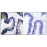 4E-BP1 (Phospho-Ser64) Antibody from Signalway Antibody (12124) - Antibodies.com