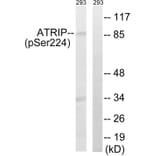 Western blot - ATRIP (Phospho-Ser224) Antibody from Signalway Antibody (12130) - Antibodies.com