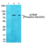 Western blot - ATRIP (Phospho-Ser224) Antibody from Signalway Antibody (12130) - Antibodies.com