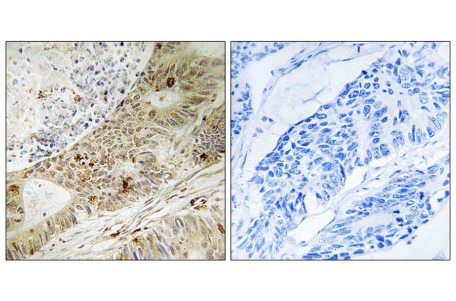 Immunohistochemistry - ATRIP (Phospho-Ser224) Antibody from Signalway Antibody (12130) - Antibodies.com