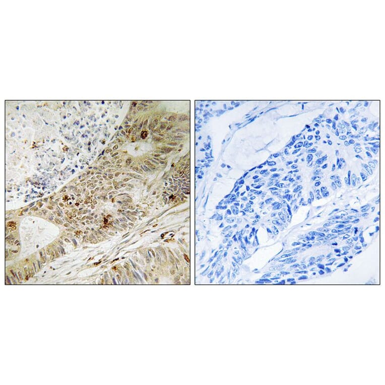 Immunohistochemistry - ATRIP (Phospho-Ser224) Antibody from Signalway Antibody (12130) - Antibodies.com