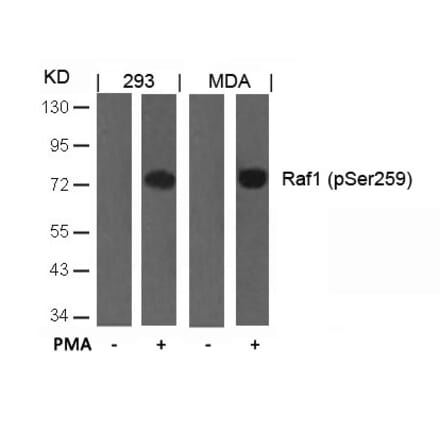 Western blot - Raf1 (Phospho-Ser259) Antibody from Signalway Antibody (11006) - Antibodies.com
