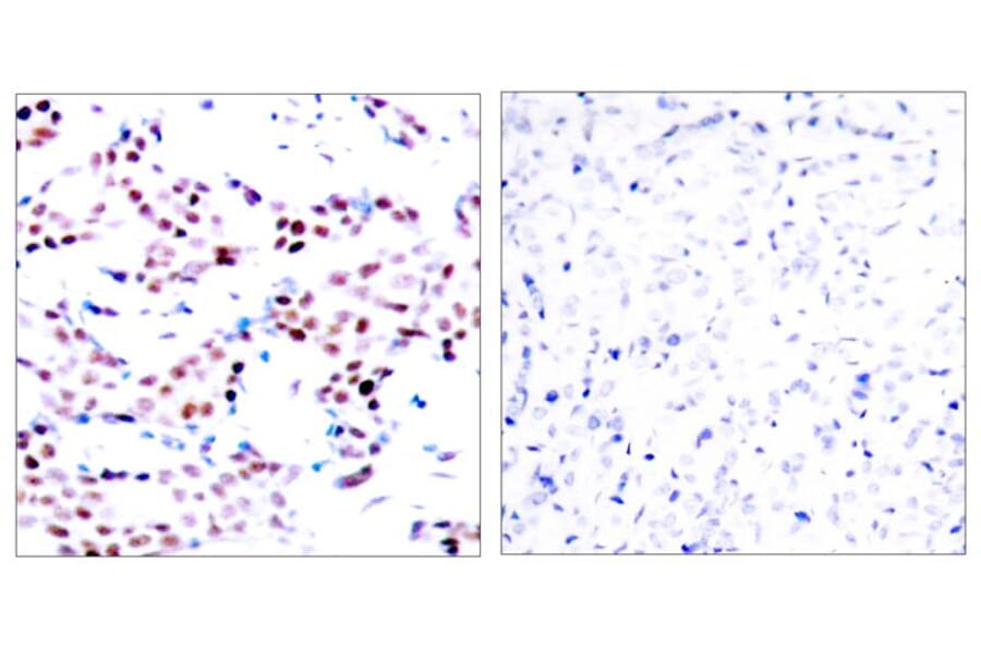 Immunohistochemistry - c-Jun (Phospho-Thr91) Antibody from Signalway Antibody (11021) - Antibodies.com