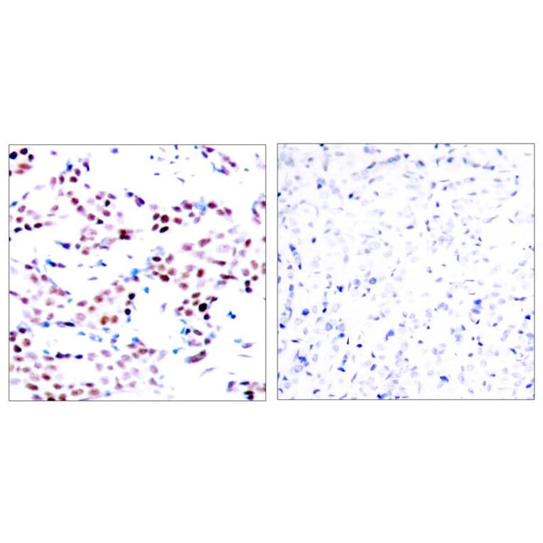 Immunohistochemistry - c-Jun (Phospho-Thr91) Antibody from Signalway Antibody (11021) - Antibodies.com