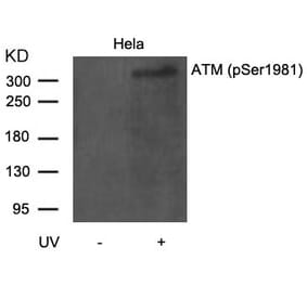 Western blot - ATM (Phospho-Ser1981) Antibody from Signalway Antibody (11122) - Antibodies.com