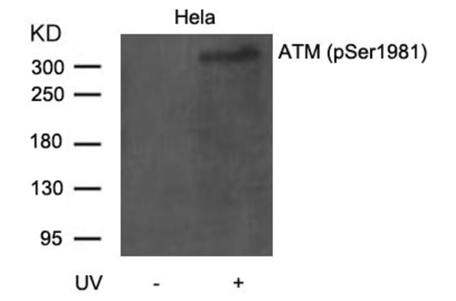 Western blot - ATM (Phospho-Ser1981) Antibody from Signalway Antibody (11122) - Antibodies.com