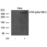 Western blot - ATM (Phospho-Ser1981) Antibody from Signalway Antibody (11122) - Antibodies.com