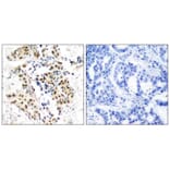 Immunohistochemistry - ATM (Phospho-Ser1981) Antibody from Signalway Antibody (11122) - Antibodies.com