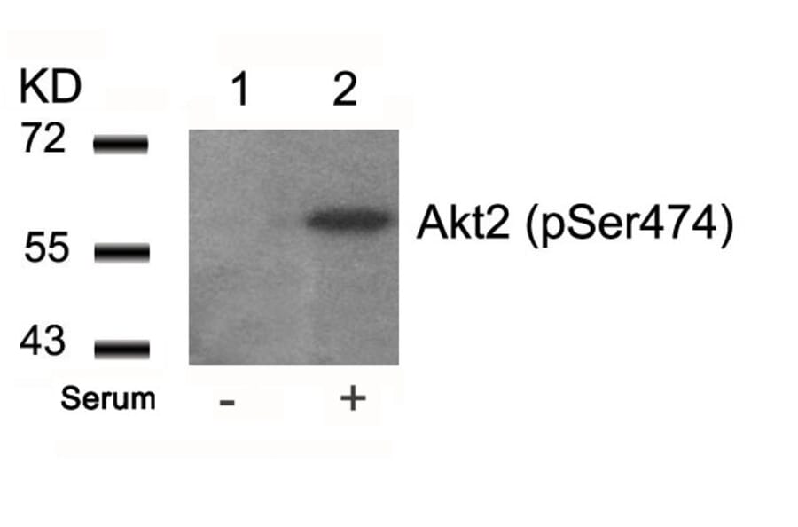 Western blot - Akt2 (Phospho-Ser474) Antibody from Signalway Antibody (11124) - Antibodies.com