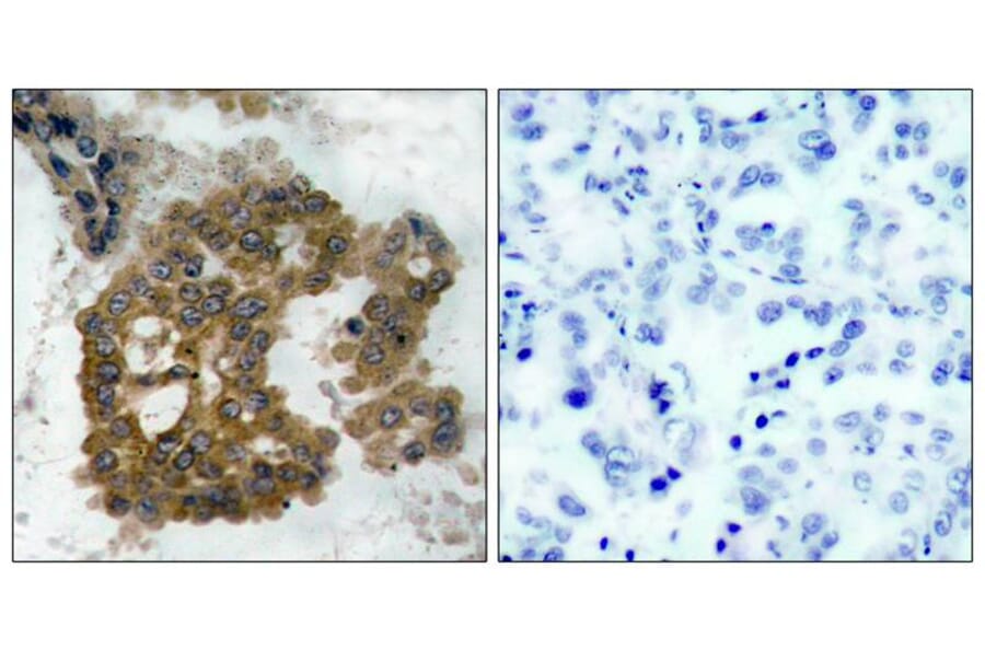 Immunohistochemistry - Akt2 (Phospho-Ser474) Antibody from Signalway Antibody (11124) - Antibodies.com