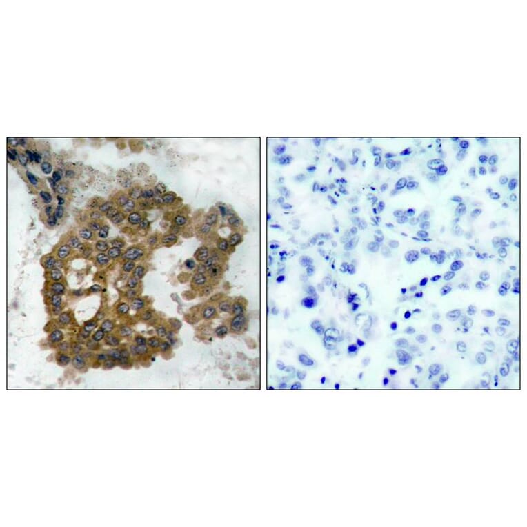 Immunohistochemistry - Akt2 (Phospho-Ser474) Antibody from Signalway Antibody (11124) - Antibodies.com