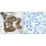 Immunohistochemistry - Akt2 (Phospho-Ser474) Antibody from Signalway Antibody (11124) - Antibodies.com