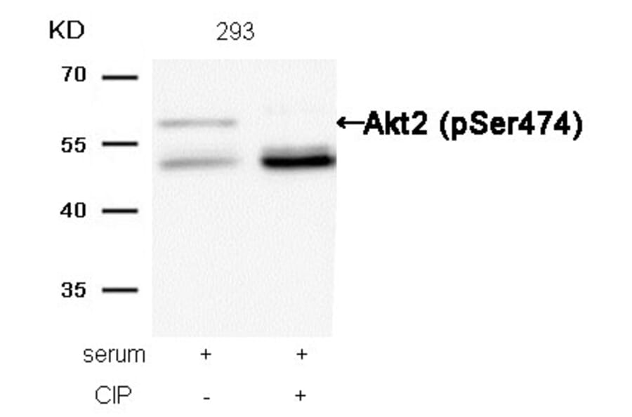 Western blot - Akt2 (Phospho-Ser474) Antibody from Signalway Antibody (11124) - Antibodies.com