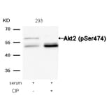 Western blot - Akt2 (Phospho-Ser474) Antibody from Signalway Antibody (11124) - Antibodies.com