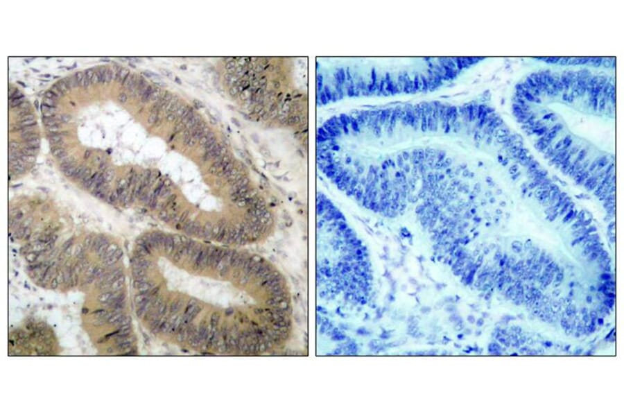 Immunohistochemistry - IKK a (Phospho-Thr23) Antibody from Signalway Antibody (11129) - Antibodies.com