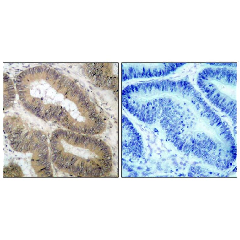 Immunohistochemistry - IKK a (Phospho-Thr23) Antibody from Signalway Antibody (11129) - Antibodies.com