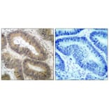 Immunohistochemistry - IKK a (Phospho-Thr23) Antibody from Signalway Antibody (11129) - Antibodies.com