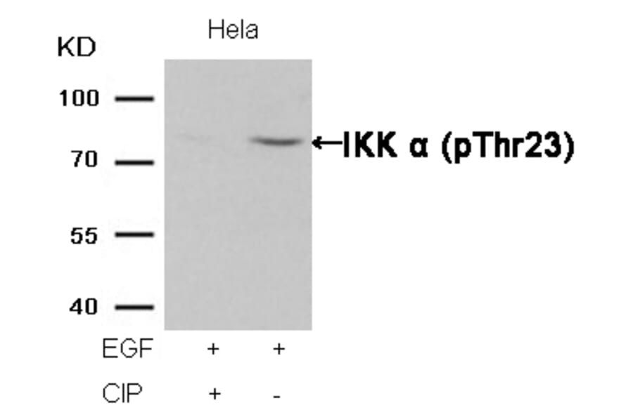Western blot - IKK a (Phospho-Thr23) Antibody from Signalway Antibody (11129) - Antibodies.com