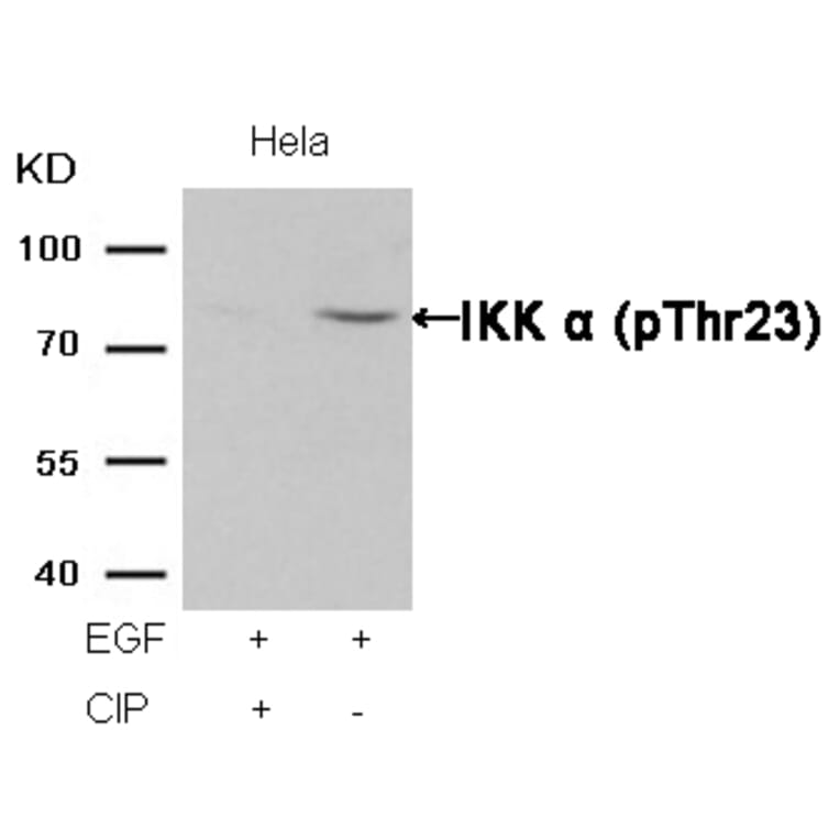 Western blot - IKK a (Phospho-Thr23) Antibody from Signalway Antibody (11129) - Antibodies.com