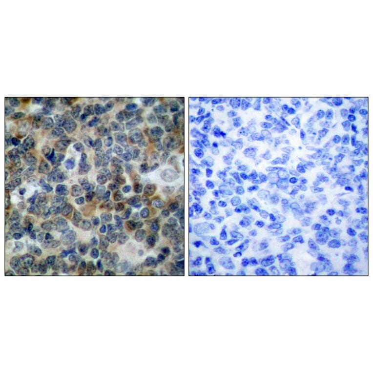 Immunohistochemistry - VASP (Phospho-Ser239) Antibody from Signalway Antibody (11158) - Antibodies.com