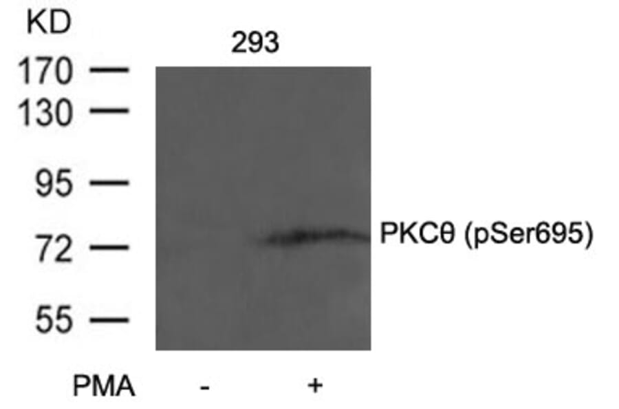 Western blot - PKCth (Phospho-Ser695) Antibody from Signalway Antibody (11173) - Antibodies.com