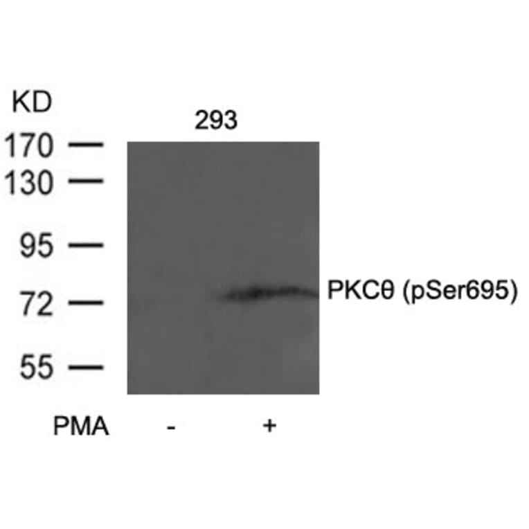 Western blot - PKCth (Phospho-Ser695) Antibody from Signalway Antibody (11173) - Antibodies.com