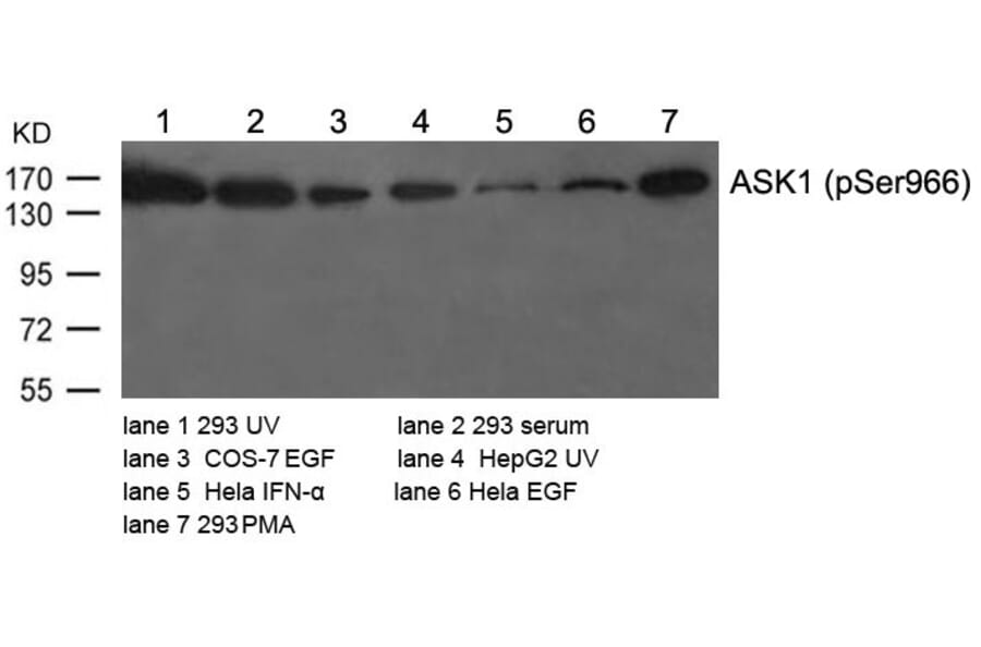 Western blot - ASK1 (Phospho-Ser966) Antibody from Signalway Antibody (11179) - Antibodies.com