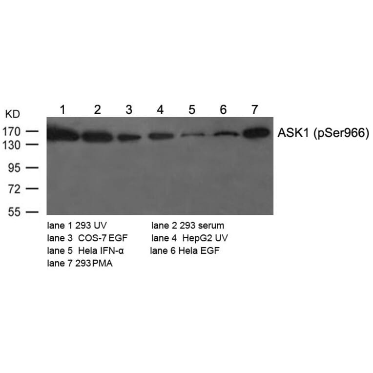 Western blot - ASK1 (Phospho-Ser966) Antibody from Signalway Antibody (11179) - Antibodies.com