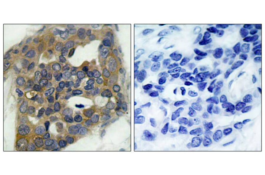 Immunohistochemistry - ASK1 (Phospho-Ser966) Antibody from Signalway Antibody (11179) - Antibodies.com