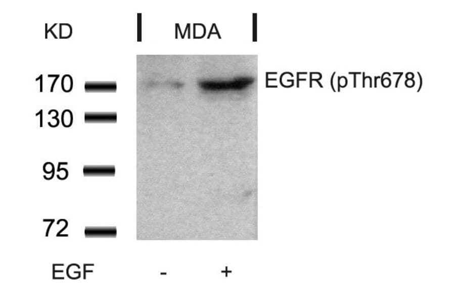 Western blot - EGFR (Phospho-Thr678) Antibody from Signalway Antibody (11186) - Antibodies.com