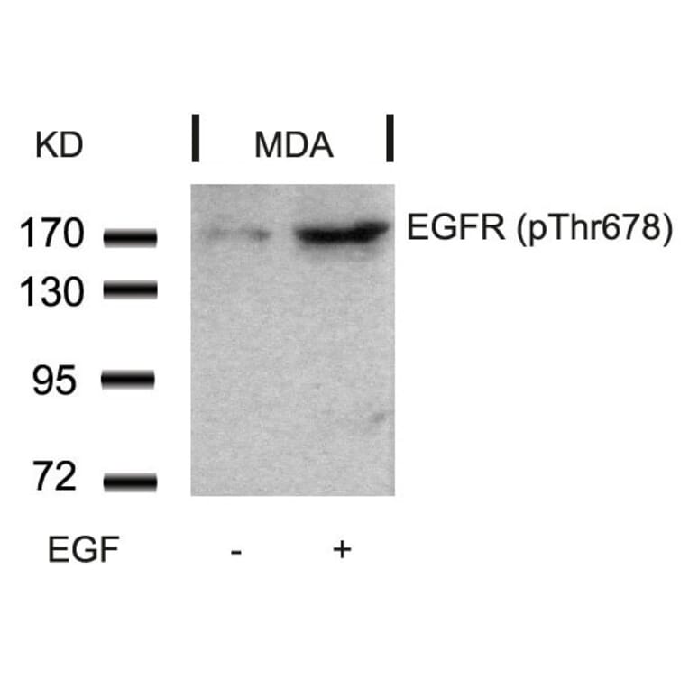 Western blot - EGFR (Phospho-Thr678) Antibody from Signalway Antibody (11186) - Antibodies.com