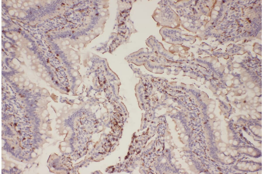 Immunohistochemistry - EGFR (Phospho-Thr678) Antibody from Signalway Antibody (11186) - Antibodies.com