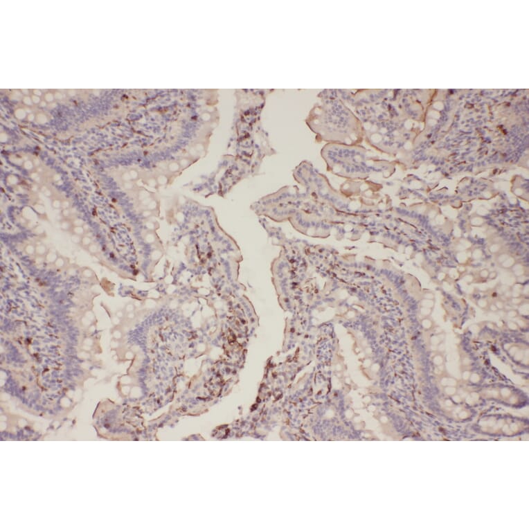 Immunohistochemistry - EGFR (Phospho-Thr678) Antibody from Signalway Antibody (11186) - Antibodies.com