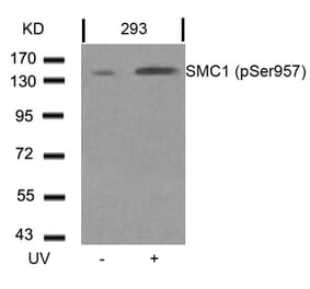 Western blot - SMC1 (Phospho-Ser957) Antibody from Signalway Antibody (11198) - Antibodies.com
