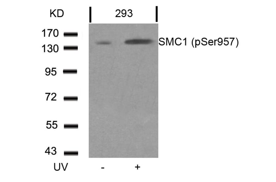 Western blot - SMC1 (Phospho-Ser957) Antibody from Signalway Antibody (11198) - Antibodies.com