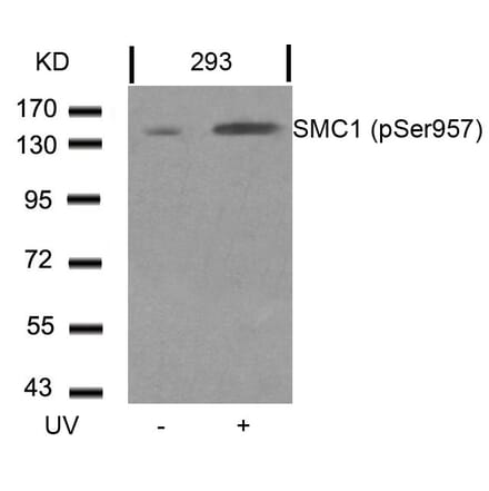 Western blot - SMC1 (Phospho-Ser957) Antibody from Signalway Antibody (11198) - Antibodies.com